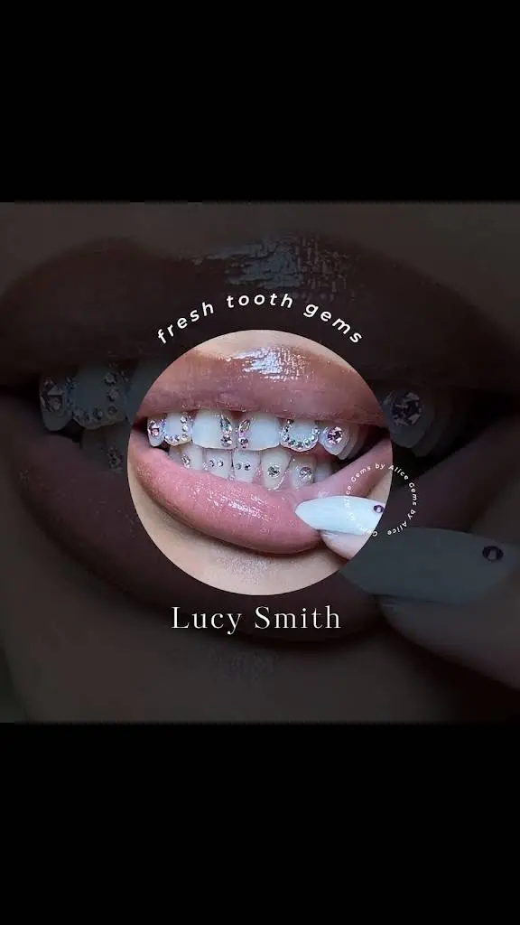 Pure White Smiles And Gems