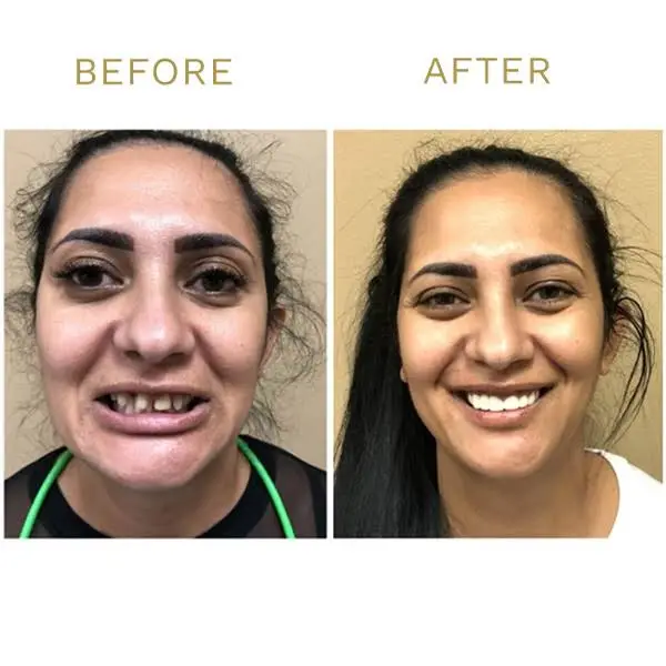 Tinley Park Smiles & Implant Dentistry
