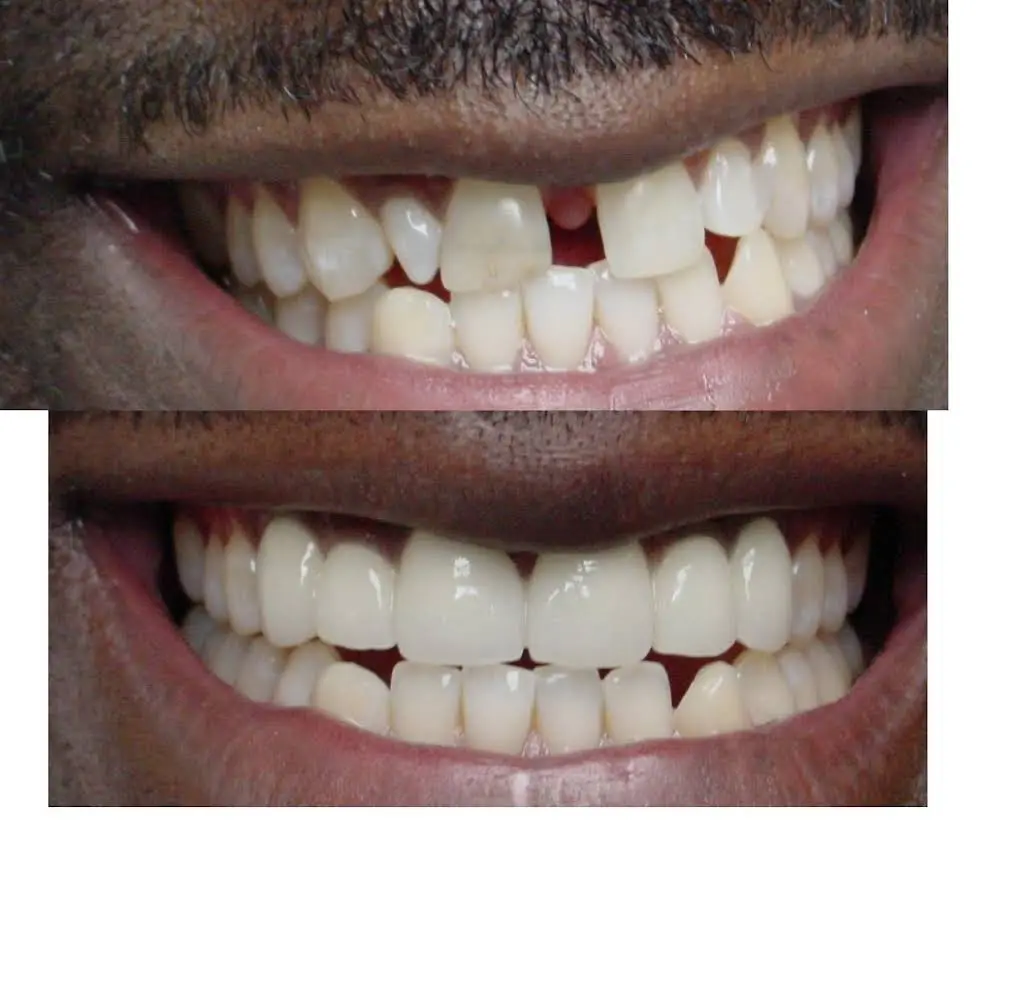 Dental Care 4U