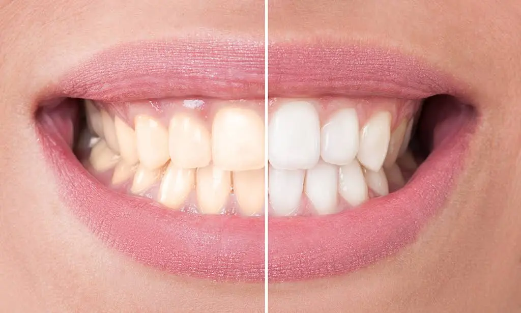 Dental Care 4U