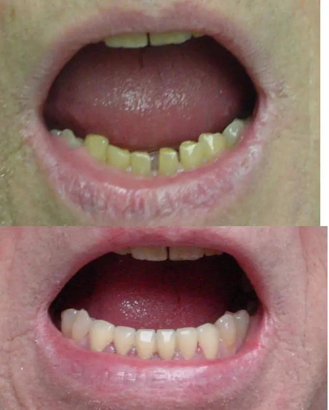 Dental Care 4U