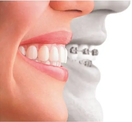 Dental Care 4U
