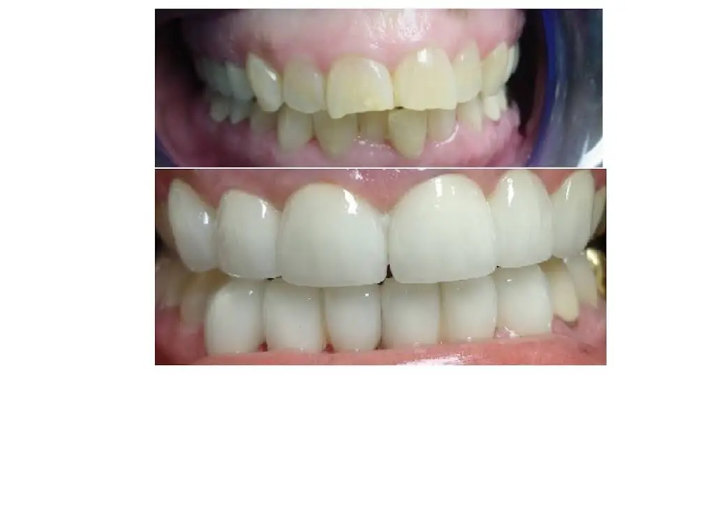 Dental Care 4U