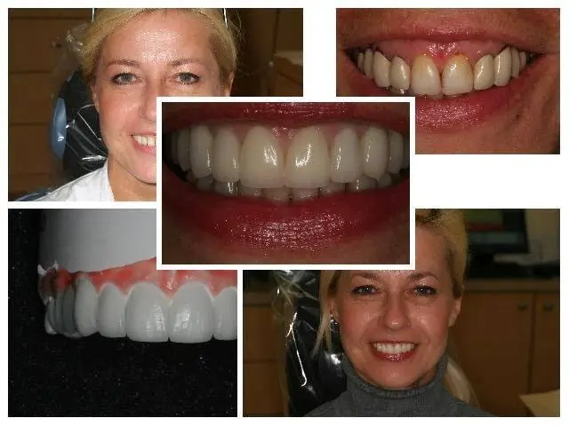 Gibberman Dental