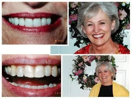 Gibberman Dental