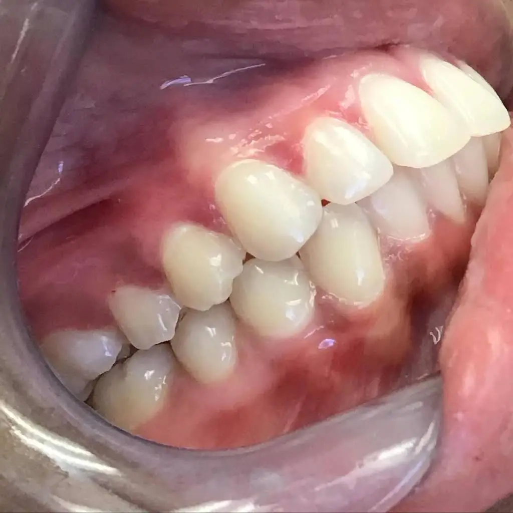 Aspen Hill Implant and Family Dentistry