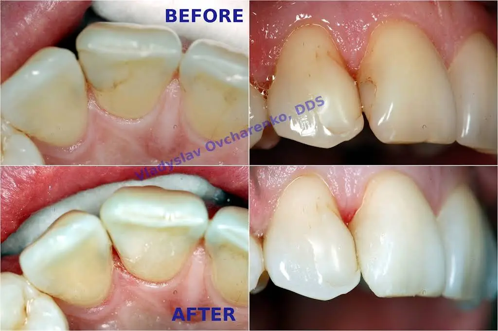 Fairfax City Dentist PLC. Vladyslav Ovcharenko, DDS