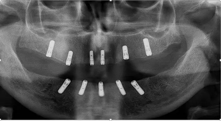 Sundance Implant and Periodontal Center