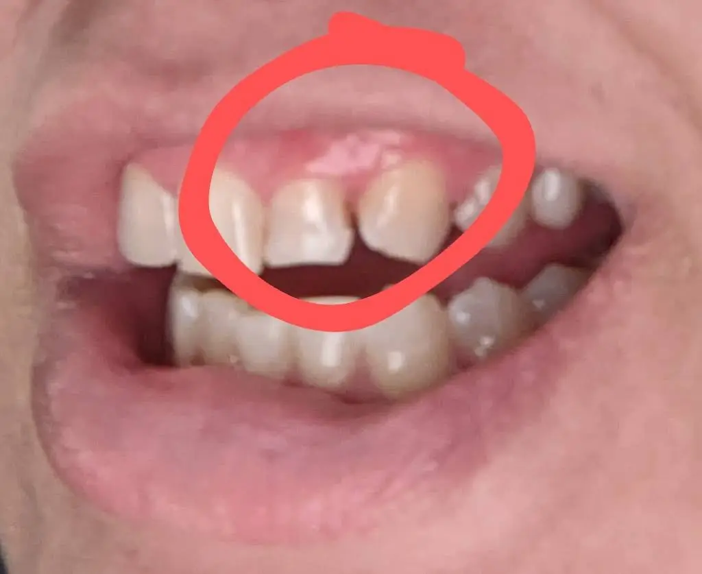 Iowa City Dental Health