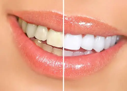 Wintergreen Family Dentistry: Huixin Wang, DDS