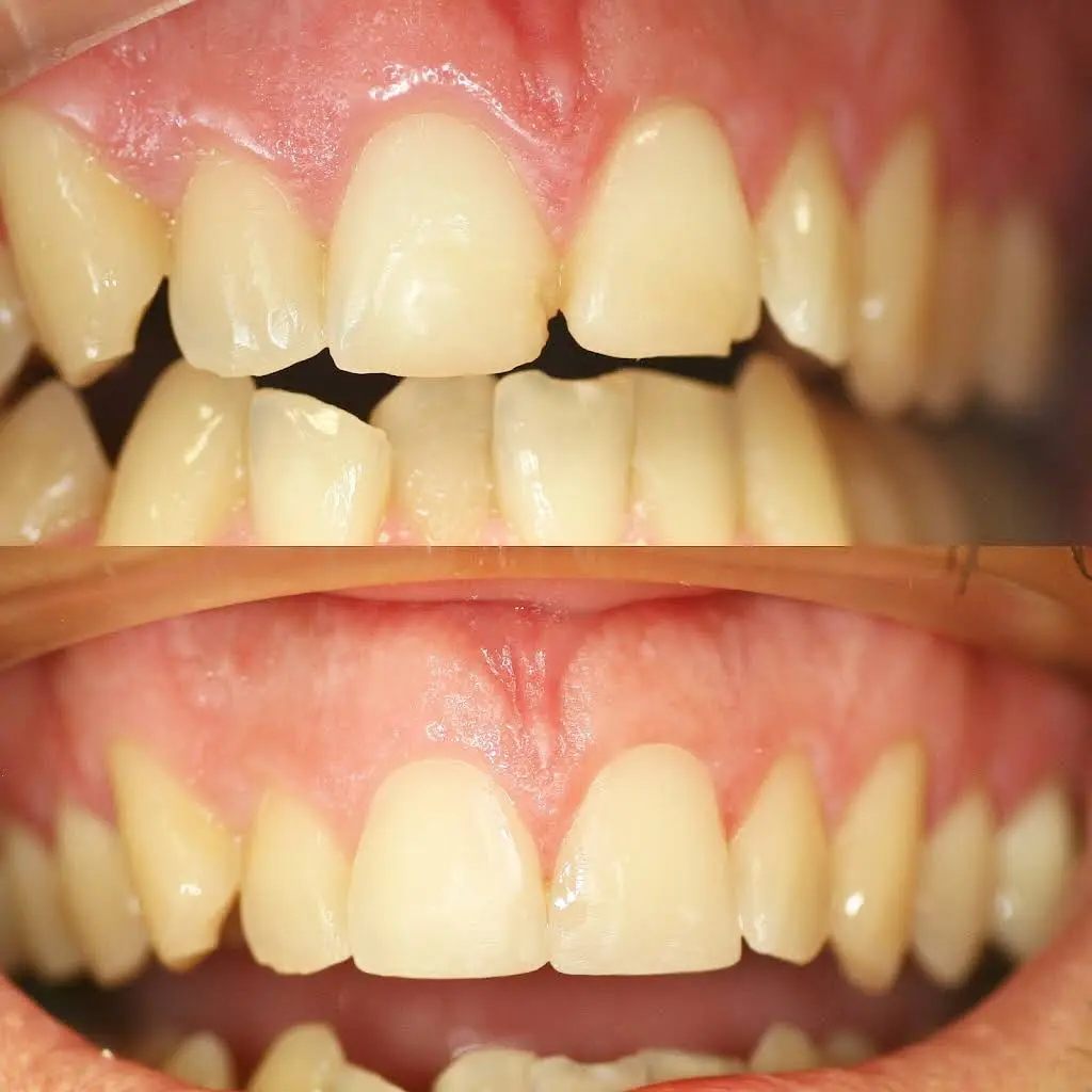 Maintain Your Smile Dental