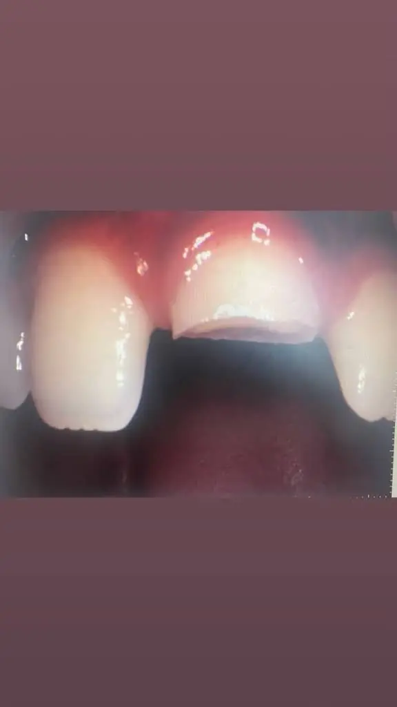 Pediatric Dentistry of Northern Illinois