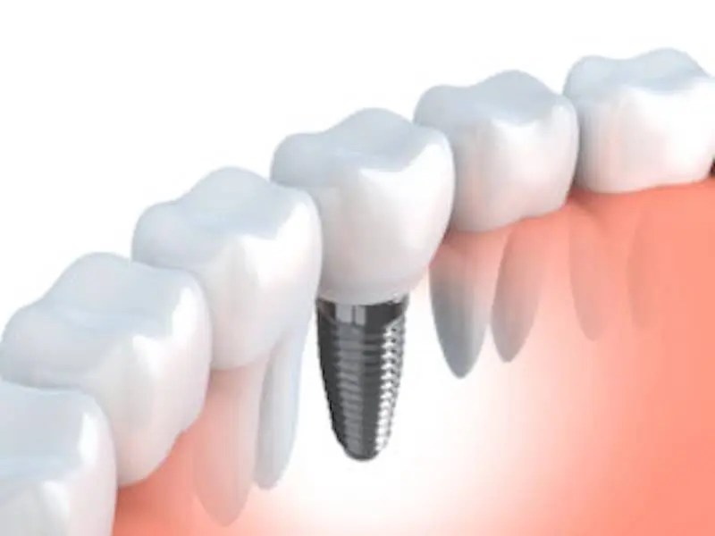 Potomac Family Dental