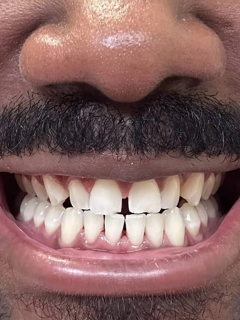 Smile Loft Glen Burnie - Professional dental clinic exterior with modern facilities