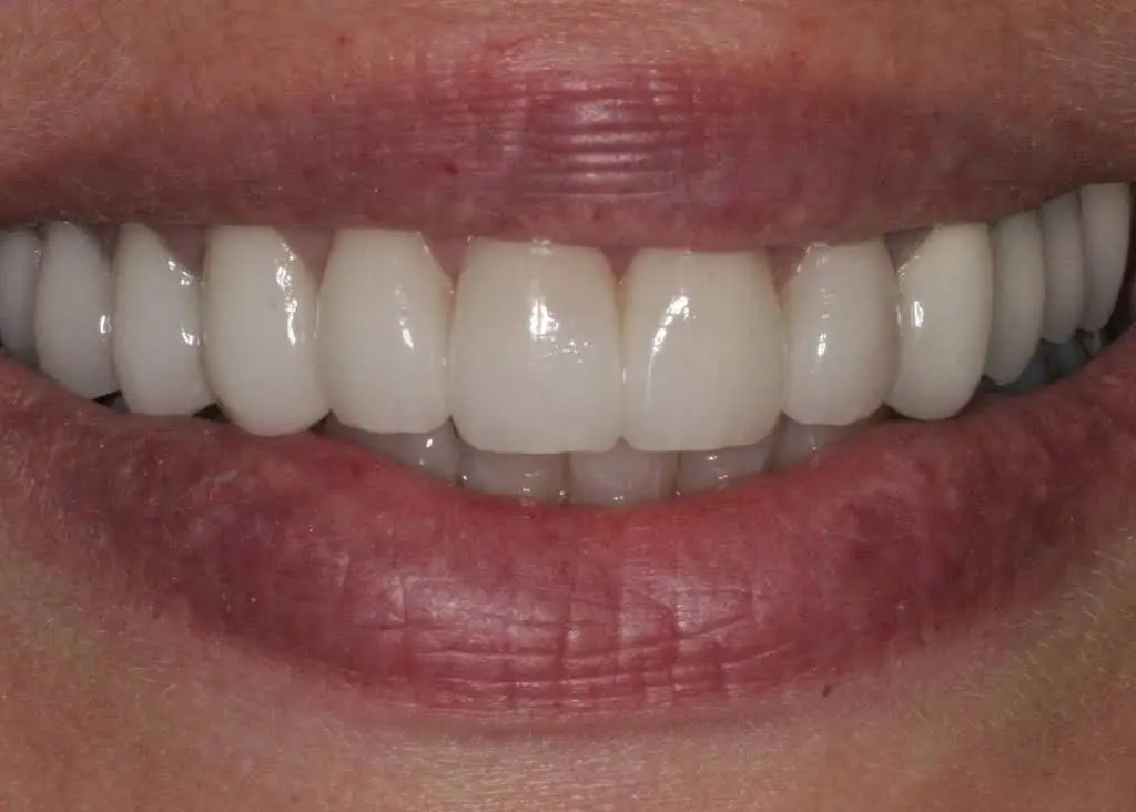 Smiles of Chesterton - Professional dental clinic exterior with modern facilities