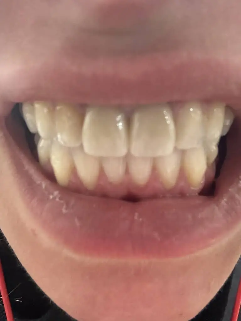 Precision Dental of Westminster - Professional dental clinic exterior with modern facilities