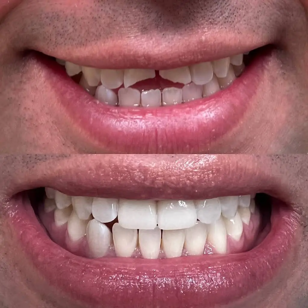 Lakeshore Dental - Professional dental clinic exterior with modern facilities