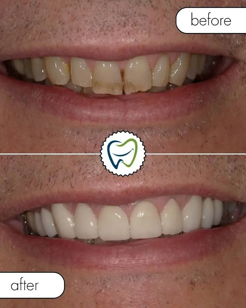 Grand Avenue Smiles - Professional dental clinic exterior with modern facilities