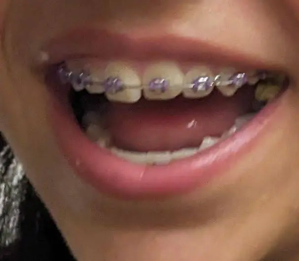 Central Dental
