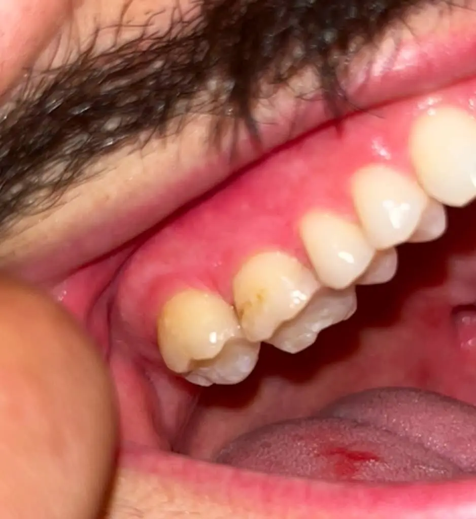 Gentle Dental Care