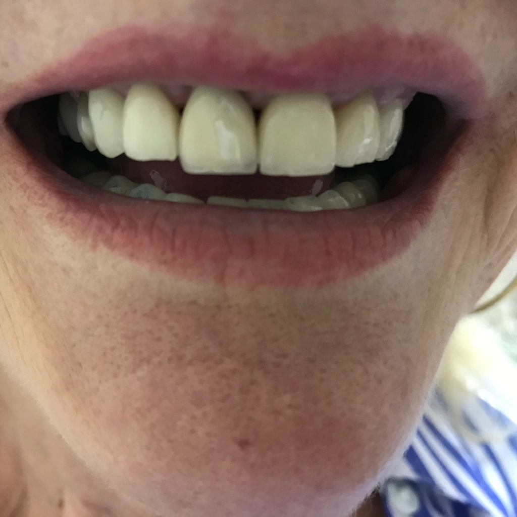 Family Dental Care - Dr. K Singh DDS - Professional dental clinic exterior with modern facilities