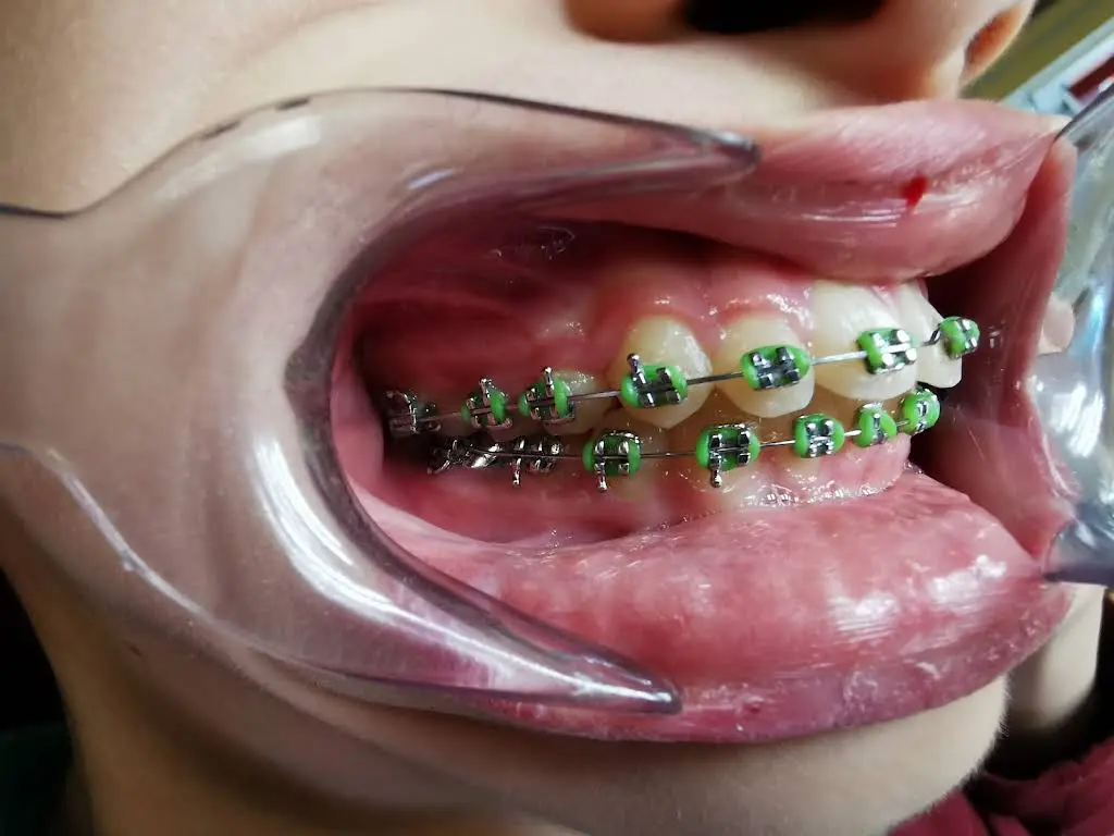 Confluence Dental Wenatchee