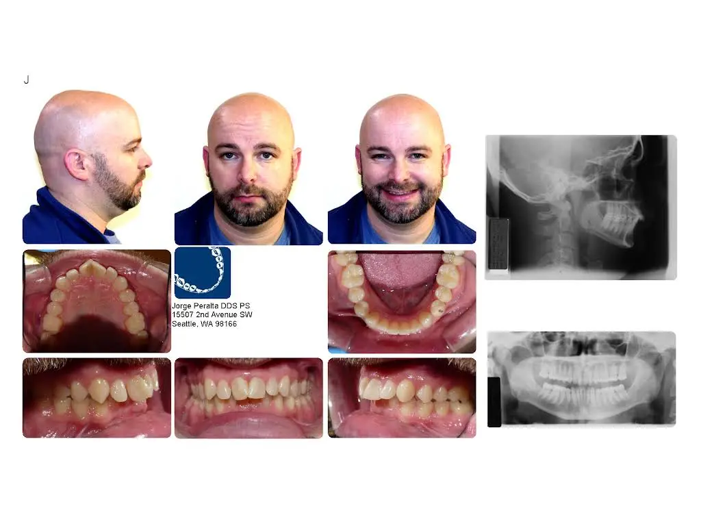 Peralta Orthodontics - West Seattle