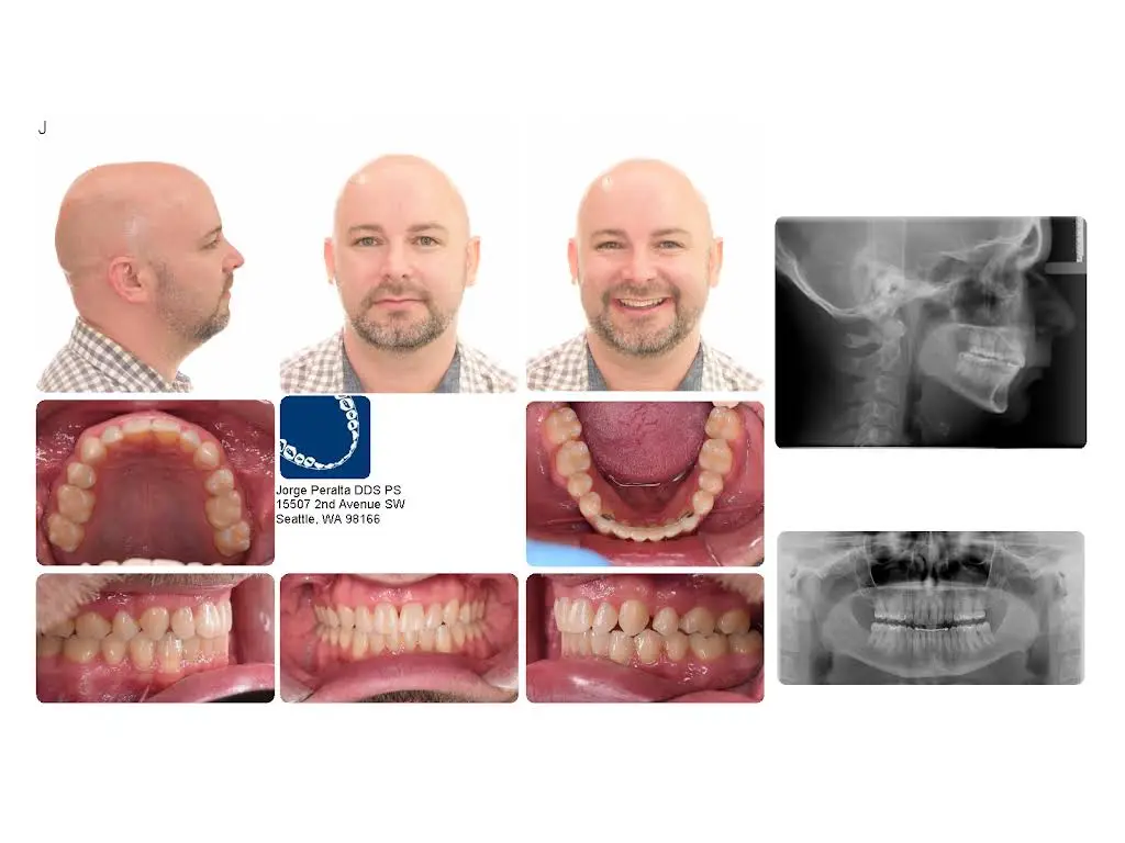 Peralta Orthodontics - West Seattle
