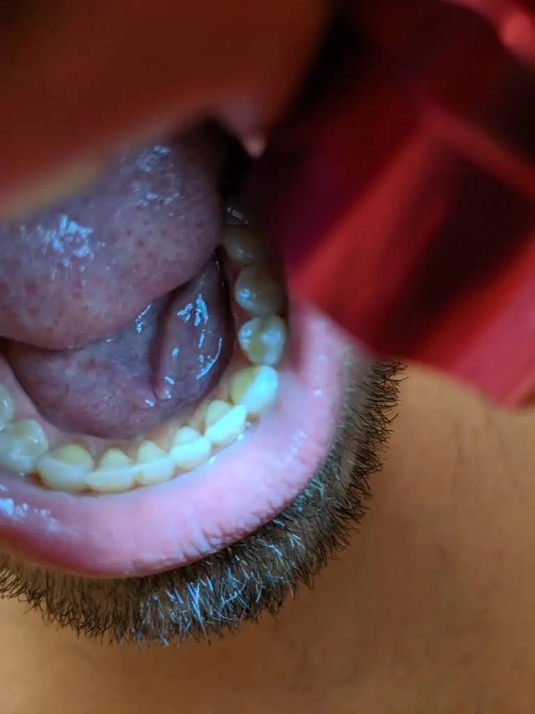 Seattle Sound Dental
