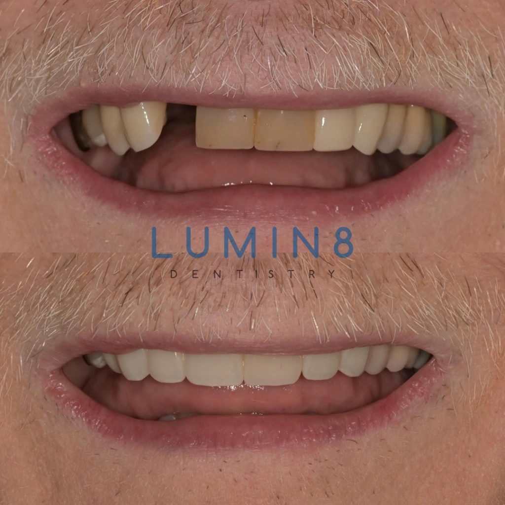 Lumin8 Dentistry - Professional dental clinic exterior with modern facilities