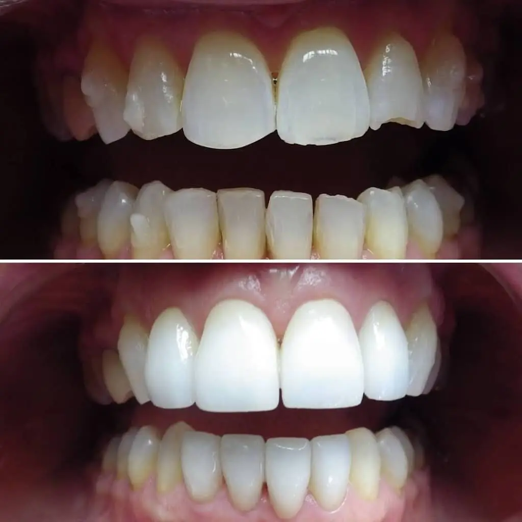 Wonderful Smiles