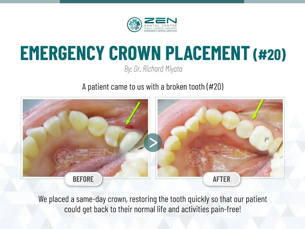 Zen Dental Center - Professional dental clinic exterior with modern facilities