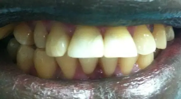 South Everett Cascade Dentistry