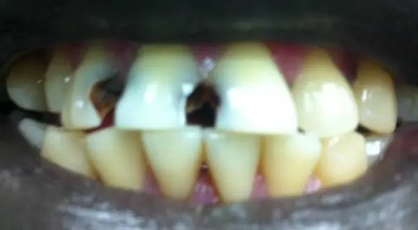 South Everett Cascade Dentistry