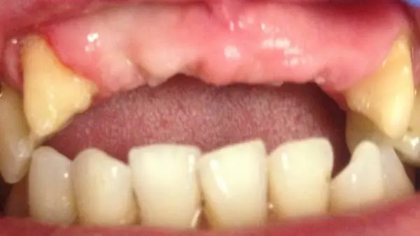 South Everett Cascade Dentistry