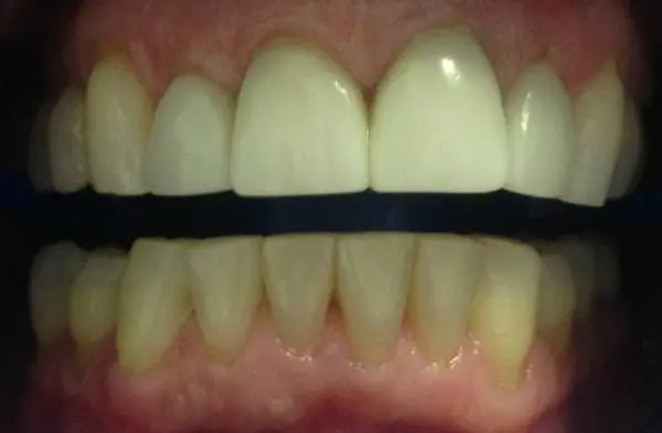 South Everett Cascade Dentistry