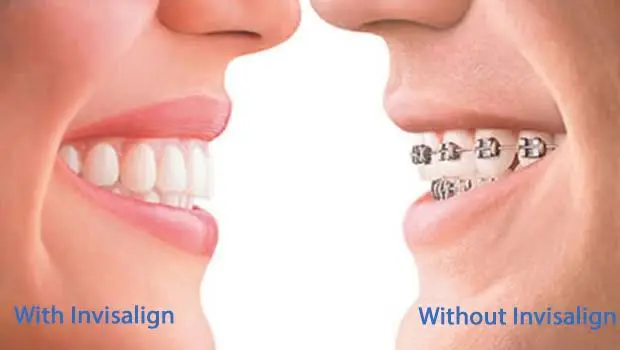 LifeSmiles Complete Health Dentistry