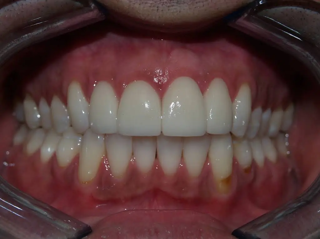 Boyne City Dental