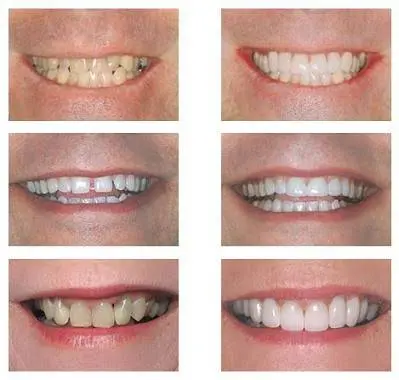 Dr. Mikesell Family Dentistry