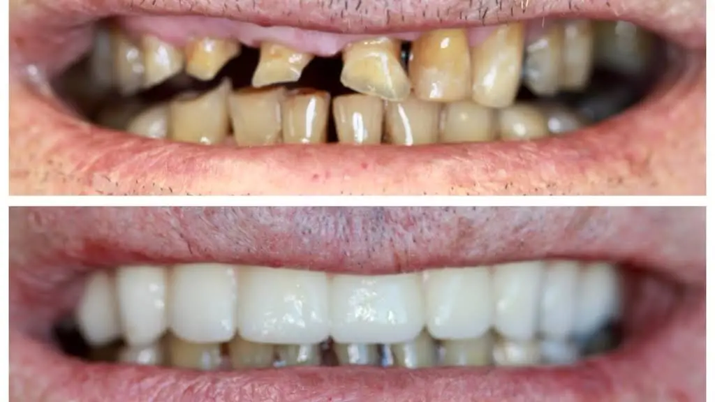 Carroll Family Dentistry - Professional dental clinic exterior with modern facilities