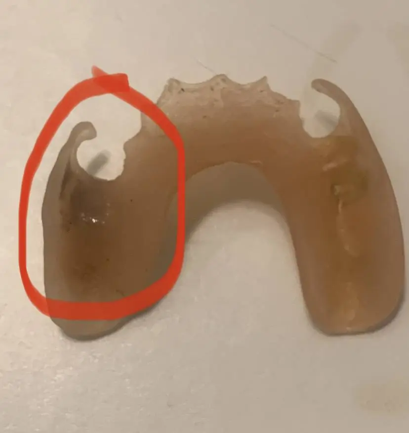 Dentures In A Day