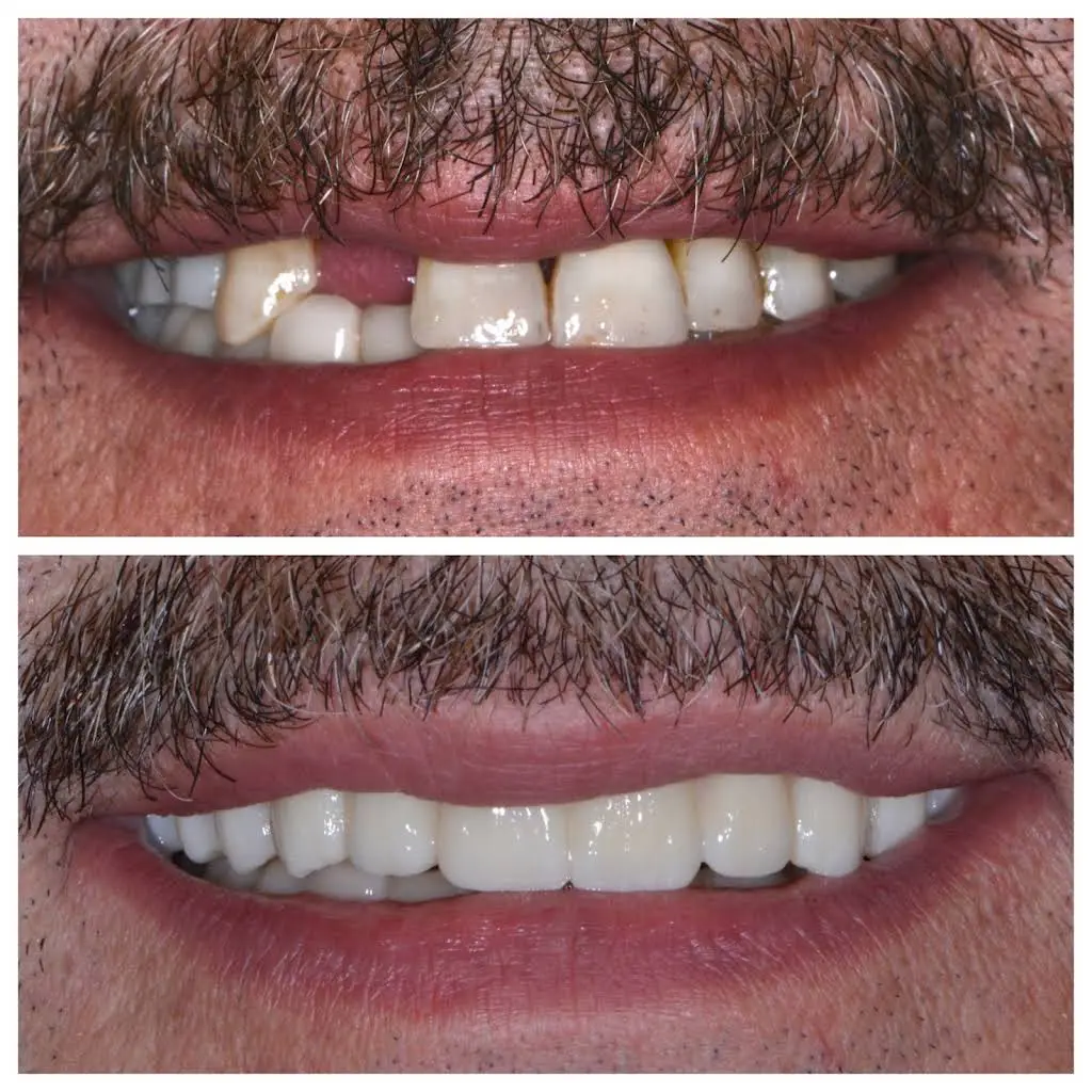 Clarkston Dental Care - Professional dental clinic exterior with modern facilities