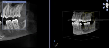 Endodontic Services, Inc.