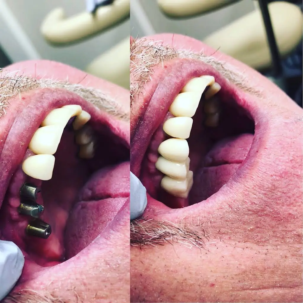 Troy Smiles: Cosmetic and Implant Dentistry - Professional dental clinic exterior with modern facilities