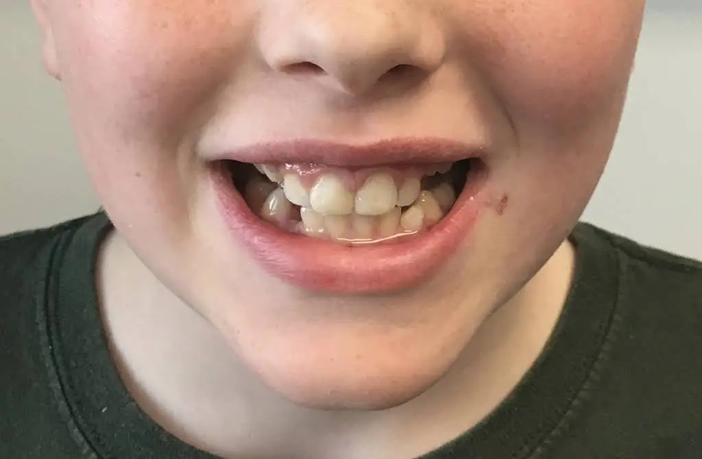 LifeSmiles Pediatric Dentistry