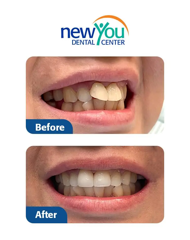 New You Dental Center - Professional dental clinic exterior with modern facilities