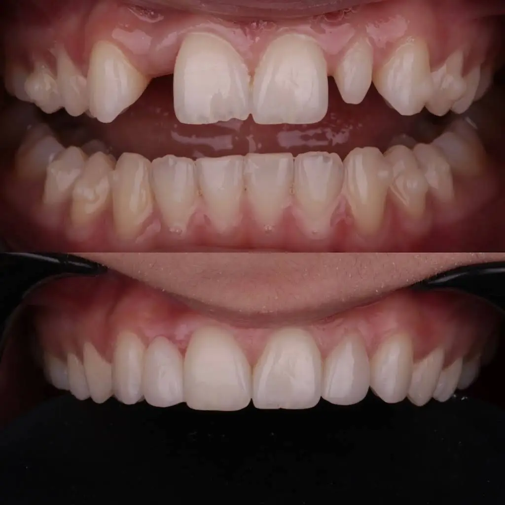 Byond Dental - Professional dental clinic exterior with modern facilities