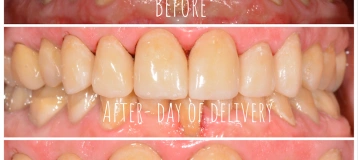 Smiles For Life- Dr. Nate Heffelfinger