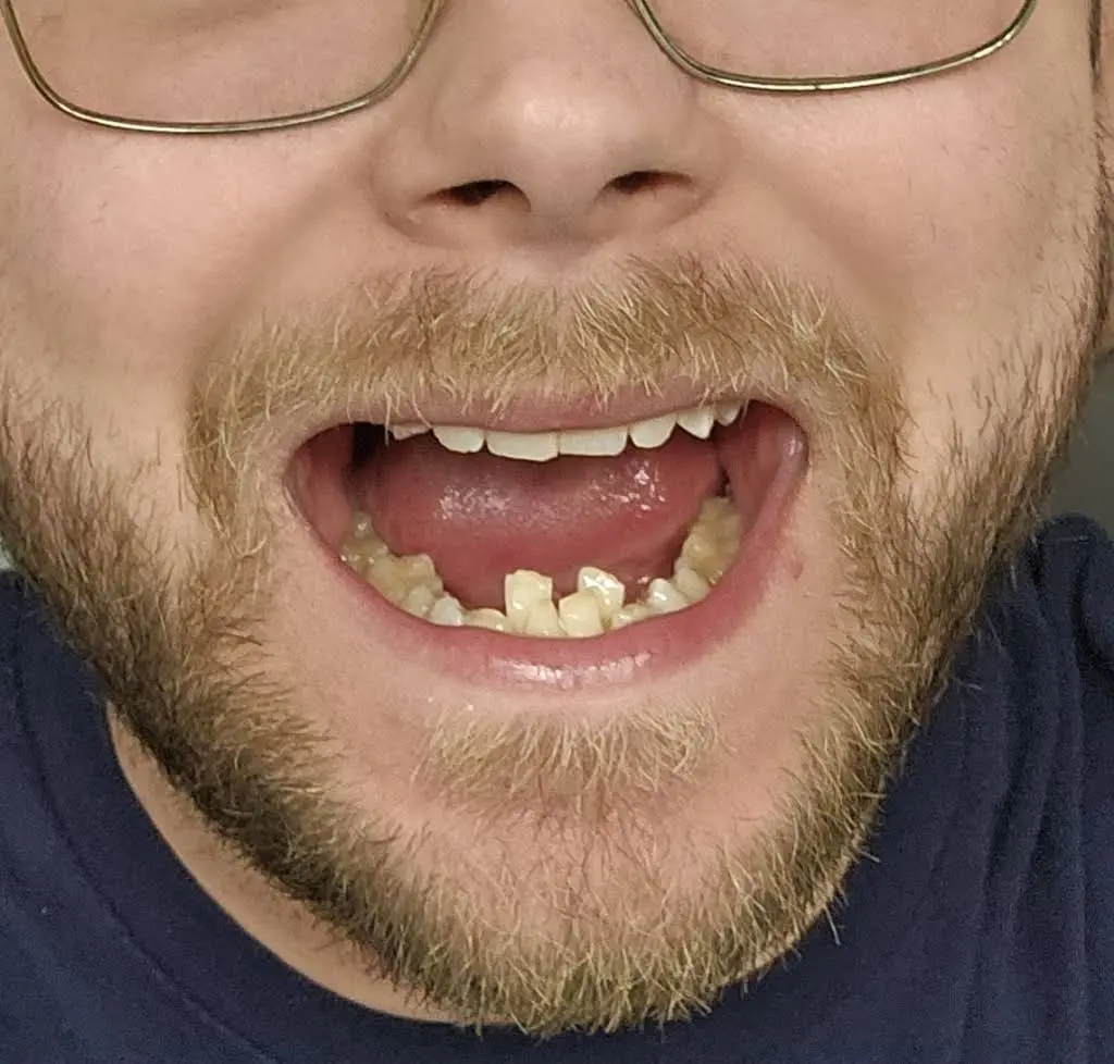 Aspen Dental