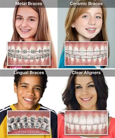 Hagler Orthodontics